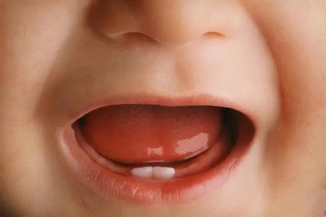 寶寶幾個月長牙？多留意出牙前的這4個“信號”